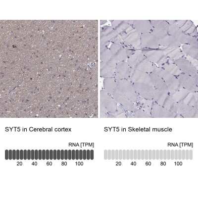 <b>Orthogonal Strategies Validation. </b>Immunohistochemistry-Paraffin: Synaptotagmin 5 Antibody [NBP2-62725] - Analysis in human cerebral cortex and skeletal muscle tissues using Anti-SYT5 antibody. Corresponding SYT5 RNA-seq data are presented for the same tissues.