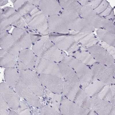 Immunohistochemistry-Paraffin: Synaptotagmin 5 Antibody [NBP2-62725] - Staining of human skeletal muscle shows low expression as expected.