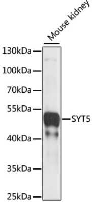 Western Blot: Synaptotagmin 5 Antibody [NBP2-94665] - Analysis of extracts of Mouse kidney, using Synaptotagmin 5 at 1:1000 dilution.Secondary antibody: HRP Goat Anti-Rabbit IgG (H+L) at 1:10000 dilution.Lysates/proteins: 25ug per lane.Blocking buffer: 3% nonfat dry milk in TBST.Detection: ECL Basic Kit .Exposure time: 5s.