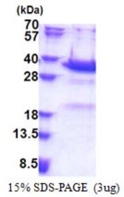 SDS-Page: Synaptotagmin 5 Protein [NBP2-22838]