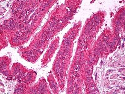 Immunohistochemistry-Paraffin: Synaptotagmin 6 Antibody [NBP2-11539] - Analysis of anti-SYT6 antibody with human lung, respiratory epithelium at dilution 1:200.