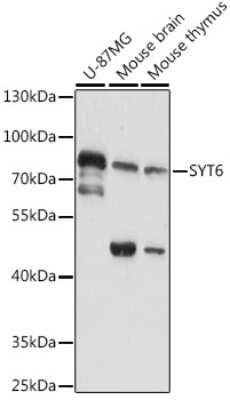 Western Blot Synaptotagmin 6 Antibody - Azide and BSA Free