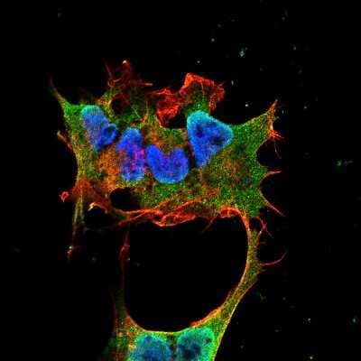Immunocytochemistry/Immunofluorescence: Synaptotagmin VI Antibody (S270-47) [NBP2-22421] - Tissue: Neuroblastoma cell line SK-N-BE. Species: Human. Fixation: 4% Formaldehyde for 15 min at RT. Primary Antibody: Mouse Anti-Synaptotagmin-6 Monoclonal Antibody at 1:100 for 60 min at RT. Secondary Antibody: Goat Anti-Mouse ATTO 488 at 1:100 for 60 min at RT. Counterstain: Phalloidin Texas Red F-Actin stain; DAPI (blue) nuclear stain at 1:1000; 1:5000 for 60 min RT, 5 min RT. Localization: Cytoplasmic Vesicle, Nucleus. Magnification: 60X.
