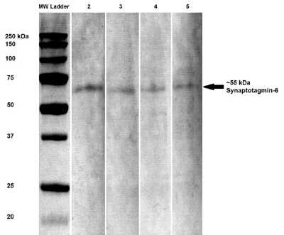 Western Blot: Synaptotagmin VI Antibody (S270-47) [NBP2-22421] - analysis of Rat brain lysates showing detection of Synaptotagmin 6 protein using Mouse Anti-Synaptotagmin 6 Monoclonal Antibody, Clone S270-47 . Primary Antibody: Mouse Anti-Synaptotagmin 6 Monoclonal Antibody at 1:100, 1:250, 1:500, and 1:1000.