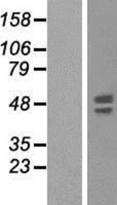 Western Blot: Synaptotagmin VI Overexpression Lysate (Adult Normal) [NBP2-04529] Left-Empty vector transfected control cell lysate (HEK293 cell lysate); Right -Over-expression Lysate for Synaptotagmin VI.