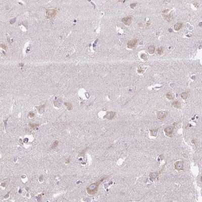 Immunohistochemistry-Paraffin Syntabulin/GOLSYN Antibody - BSA Free