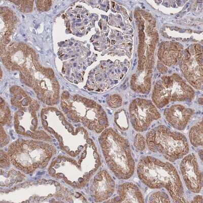 Immunohistochemistry-Paraffin: Syntaphilin Antibody [NBP2-13358] - Staining of human kidney shows moderate cytoplasmic positivity in cells in tubules.