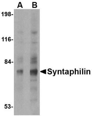 Western Blot: Syntaphilin Antibody [NBP1-76908] - Human brain tissue lysate with Syntaphilin antibody at (A) 2 and (B) 4 ug/mL.