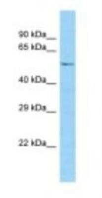 Western Blot: Syntaphilin Antibody [NBP1-98477] - Mouse Thymus Lysate 1.0ug/ml, Gel Concentration: 12%