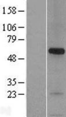 Western Blot: Syntaphilin Overexpression Lysate (Adult Normal) [NBL1-16283] Left-Empty vector transfected control cell lysate (HEK293 cell lysate); Right -Over-expression Lysate for Syntaphilin.