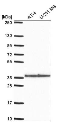 Western Blot: Syntaxin 12 Antibody [NBP2-58568] - Analysis in human cell line RT-4 and human cell line U-251 MG.