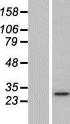 Western Blot: Syntaxin 12 Overexpression Lysate (Adult Normal) [NBP2-05037] Left-Empty vector transfected control cell lysate (HEK293 cell lysate); Right -Over-expression Lysate for Syntaxin 12.