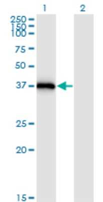 Western Blot: Syntaxin 16 Antibody (3D12) [H00008675-M03] - Analysis of STX16 expression in transfected 293T cell line by STX16 monoclonal antibody (M03), clone 3D12. Lane 1: STX16 transfected lysatE (34.8 KDa). Lane 2: Non-transfected lysate.