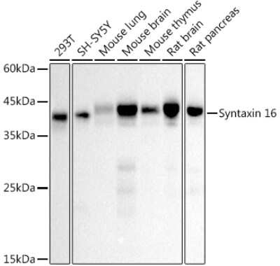 Western Blot: Syntaxin 16 Antibody (5H6D5) [NBP3-16810] - Western blot analysis of extracts of various cell lines, using (NBP3-16810) at 1:500 dilution. Secondary antibody: HRP Goat Anti-Rabbit IgG (H+L) at 1:10000 dilution. Lysates/proteins: 25ug per lane. Blocking buffer: 3% nonfat dry milk in TBST. Detection: ECL Basic Kit. Exposure time: 10s.