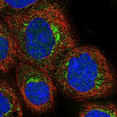 Immunocytochemistry/Immunofluorescence: Syntaxin 16 Antibody [NBP1-92467] - Staining of human cell line A-431 shows localization to vesicles. Antibody staining is shown in green.