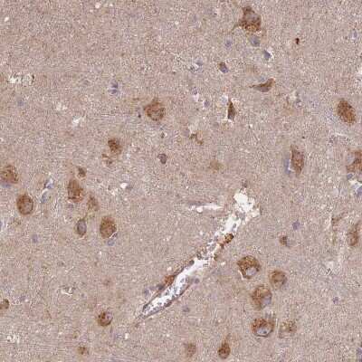 Immunohistochemistry-Paraffin: Syntaxin 16 Antibody [NBP1-92468] - Staining of human lateral ventricle shows moderate cytoplasmic positivity in neuronal cells.