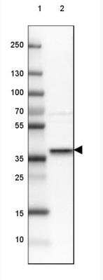 Western Blot: Syntaxin 16 Antibody [NBP1-92467] - Lane 1: Marker [kDa] 250, 130, 100, 70, 55, 35, 25, 15, 10 Lane 2: Human cell line MCF-7