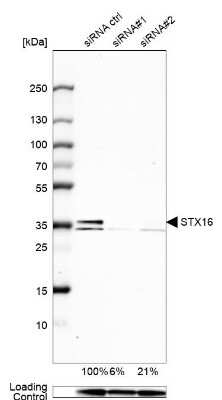 Western Blot: Syntaxin 16 Antibody [NBP1-92468] - Analysis in U-138MG cells transfected with control siRNA, target specific siRNA probe #1 and #2,. Remaining relative intensity is presented. Loading control: Anti-GAPDH.