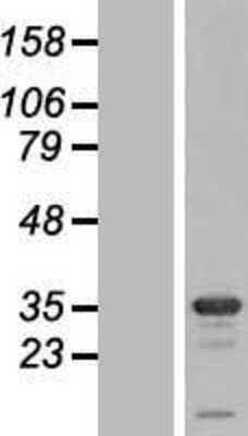 Western Blot: Syntaxin 1B Overexpression Lysate (Adult Normal) [NBL1-16579] Left-Empty vector transfected control cell lysate (HEK293 cell lysate); Right -Over-expression Lysate for Syntaxin 1B.