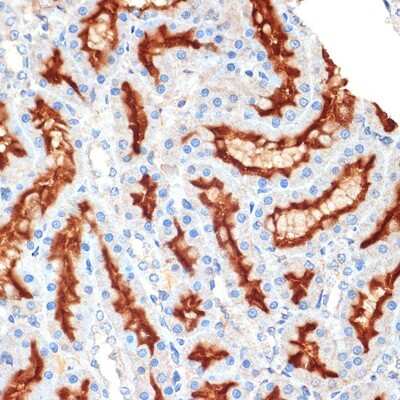 Immunohistochemistry-Paraffin: Syntaxin 3 Antibody (3L9Y9) [NBP3-16260] - Immunohistochemistry of paraffin-embedded rat kidney using Syntaxin 3 Rabbit mAb (NBP3-16260) at dilution of 1:100 (40x lens).Perform microwave antigen retrieval with 10 mM Tris/EDTA buffer pH 9.0 before commencing with IHC staining protocol.