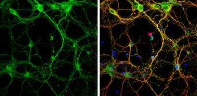 Immunocytochemistry/Immunofluorescence: Syntaxin 3 Antibody [NBP2-15131] - Syntaxin 3 antibody [N1C2] detects Syntaxin 3 protein by immunofluorescent analysis. Sample: DIV9 rat E18 primary cortical neurons were fixed in 4% paraformaldehyde at RT for 15 min. Green: Syntaxin 3 protein stained by Syntaxin 3 antibody [N1C2] diluted at 1:500. Red: beta Tubulin 3/ Tuj1, stained by beta Tubulin 3/ Tuj1 antibody [GT11710] diluted at 1:500. Blue: Fluoroshield with DAPI.