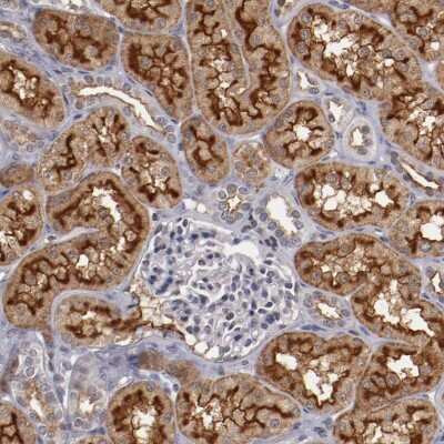 Immunohistochemistry-Paraffin: Syntaxin 3 Antibody [NBP1-86984] - Staining of human kidney shows moderate to strong positivity in cells in tubules.