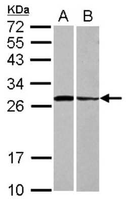 Western Blot: Syntaxin 3 Antibody [NBP2-15131] - Sample (30 ug of whole cell lysate) A: HeLa B: HCT116 12% SDS PAGE; antibody diluted at 1:1000.