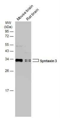 Western Blot: Syntaxin 3 Antibody [NBP2-15131] - Various tissue extracts (50 ug) were separated by 12% SDS-PAGE, and the membrane was blotted with Syntaxin 3 antibody [N1C2] diluted at 1:1000. The HRP-conjugated anti-rabbit IgG antibody was used to detect the primary antibody.