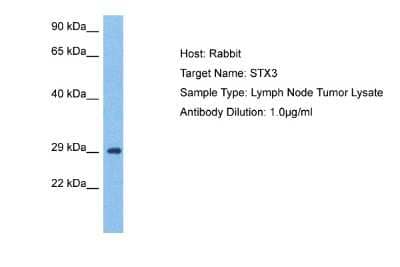 Western Blot: Syntaxin 3 Antibody [NBP2-88394] - Host: Rabbit. Target Name: STX3. Sample Tissue: Lymph Node Tumor lysates. Antibody Dilution: 1.0ug/ml