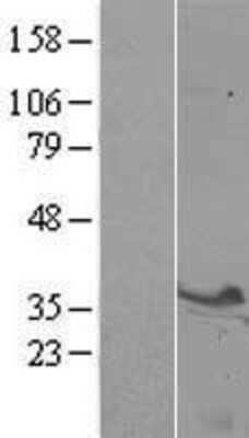 Western Blot: Syntaxin 3 Overexpression Lysate (Adult Normal) [NBL1-16581] Left-Empty vector transfected control cell lysate (HEK293 cell lysate); Right -Over-expression Lysate for Syntaxin 3.