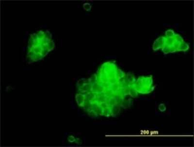 Immunocytochemistry/Immunofluorescence: Syntaxin 5 Antibody (5A6) [H00006811-M01] - Analysis of monoclonal antibody to STX5A on A-431 cell. Antibody concentration 10 ug/ml.