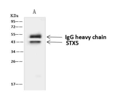 Immunoprecipitation: Syntaxin 5 Antibody [NBP3-06282] - STX5 was immunoprecipitated using:Lane A:0.5 mg HeLa Whole Cell Lysate4 uL anti-STX5 rabbit polyclonal antibody and 60 ug of Immunomagnetic beads Protein AG.Primary antibody:Anti-STX5 rabbit polyclonal antibody,at 1:100 dilution Secondary antibody:Goat Anti-Rabbit IgG (H+L) HRP at 110000 dilutionDeveloped using the ECL technique.Performed under reducing conditions.Predicted band size: 40 kDaObserved band size :43 kDa