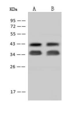 Western Blot: Syntaxin 5 Antibody [NBP3-06282] - Anti-STX5 rabbit polyclonal antibody at 1:500 dilutionLane A: HeLa Whole Cell LysateLane B: A431 Whole Cell LysateLysates/proteins at 30 ug per lane.SecondaryGoat Anti-Rabbit IgG (H+L)HRP   at 110000 dilution.Developed using the ECL technique.Performed under reducing conditions.Predicted band size:40 kDaObserved band size:42 kDa(We are unsure as to the identity of these extra bands.)
