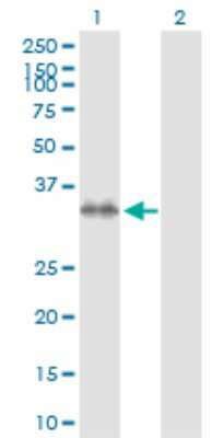 Western Blot: Syntaxin 7 Antibody [H00008417-D01P] - Analysis of STX7 expression in transfected 293T cell line by STX7 polyclonal antibody.Lane 1: STX7 transfected lysate(29.80 KDa).Lane 2: Non-transfected lysate.