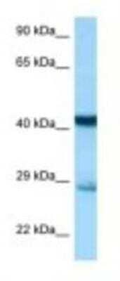 Western Blot: Syntaxin 7 Antibody [NBP1-98376] - Mouse Liver Lysate 1.0ug/ml, Gel Concentration: 12%