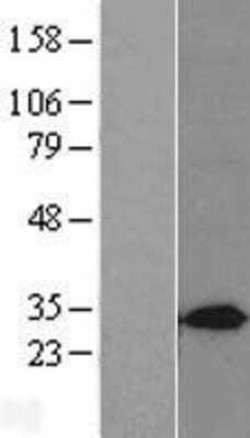 Western Blot Syntaxin 7 Overexpression Lysate