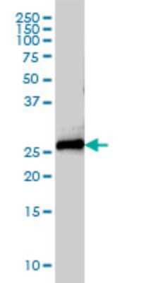 Western Blot: Syntaxin 8 Antibody (2H1-1D11) [H00009482-M01] - STX8 monoclonal antibody (M01), clone 2H1-1D11 Analysis of STX8 expression in A-431.