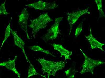 Immunocytochemistry/Immunofluorescence: Syntaxin 8 Antibody [NBP3-00260] - Immunofluorescence staining of Syntaxin 8 in Hela cells. Cells were fixed with 4% PFA, permeabilzed with 0.3% Triton X-100 in PBS, blocked with 10% serum, and incubated with rabbit anti-Human Syntaxin 8 polyclonal antibody (dilution ratio 1:1000) at 4C overnight. Then cells were stained with the Alexa Fluor$488-conjugated Goat Anti-rabbit IgG Secondary antibody (green). Positive staining was localized to cytoplasm.