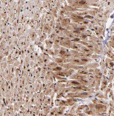 Immunohistochemistry-Paraffin: Syntaxin 8 Antibody [NBP1-91152] -  Staining of human heart muscle shows strong cytoplasmic and nuclear positivity in myocytes.