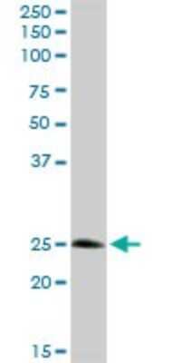 Western Blot: Syntaxin 8 Antibody [H00009482-D01P] - Analysis of STX8 expression in human kidney.