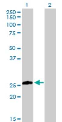 Western Blot: Syntaxin 8 Antibody [H00009482-D01P] - Analysis of STX8 expression in transfected 293T cell line by STX8 polyclonal antibody.Lane 1: STX8 transfected lysate(26.90 KDa).Lane 2: Non-transfected lysate.