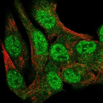 Immunocytochemistry/Immunofluorescence: Syntaxin-BP1 Antibody [NBP1-83139] - Staining of human cell line SK-MEL-30 shows localization to nucleoplasm & cytosol. Antibody staining is shown in green.