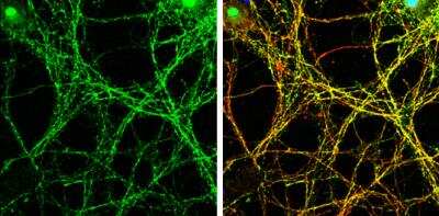 Immunocytochemistry/Immunofluorescence: Syntaxin-BP1 Antibody [NBP2-20525] - DIV9 rat E18 primary cortical neurons were fixed in 4% paraformaldehyde at RT for 15 min. Green: Syntaxin-BP1 protein stained by Syntaxin-BP1 antibody diluted at 1:500. Red: beta Tubulin 3/ Tuj1, stained by beta Tubulin 3/ Tuj1 antibody diluted at 1:500. Blue: Fluoroshield with DAPI.