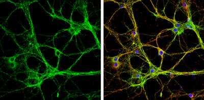 Immunocytochemistry/Immunofluorescence: Syntaxin-BP1 Antibody [NBP2-20526] - Syntaxin-BP1 antibody detects Munc18-1 protein by immunofluorescent analysis.Sample: DIV9 rat E18 primary cortical neurons were fixed in 4% paraformaldehyde at RT for 15 min. Green: Syntaxin-BP1 protein stained by Syntaxin-BP1 antibody diluted at 1:500. Red: beta Tubulin 3/ Tuj1, stained by beta Tubulin 3/ Tuj1 antibody diluted at 1:500. Blue: Fluoroshield with DAPI.