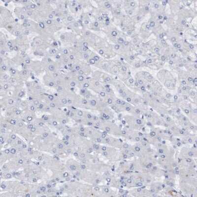 Immunohistochemistry-Paraffin: Syntaxin-BP1 Antibody [NBP1-83138] - Staining of human liver shows no cytoplasmic positivity in hepatocytes as expected.