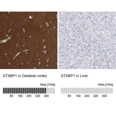 Immunohistochemistry-Paraffin: Syntaxin-BP1 Antibody [NBP1-83138] - Staining in human cerebral cortex and liver tissues . Corresponding STXBP1 RNA-seq data are presented for the same tissues.