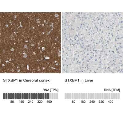 Immunohistochemistry-Paraffin: Syntaxin-BP1 Antibody [NBP1-83139] - Analysis in human cerebral cortex and liver tissues using NBP1-83139 antibody. Corresponding STXBP1 RNA-seq data are presented for the same tissues.