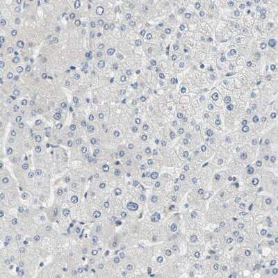 Immunohistochemistry-Paraffin: Syntaxin-BP1 Antibody [NBP1-83139] - Staining of human liver shows no positivity in hepatocytes as expected.