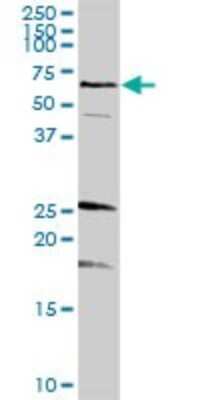 Western Blot: Syntaxin-BP1 Antibody [H00006812-D01P] - Analysis of STXBP1 expression in mouse spleen.