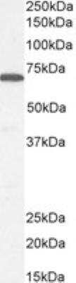 Western Blot: Syntaxin-BP1 Antibody [NB100-41370] - Staining of Human Cerebellum lysate (35 ug protein in RIPA buffer). Antibody at 0.1 ug/mL. Detected by chemiluminescence.